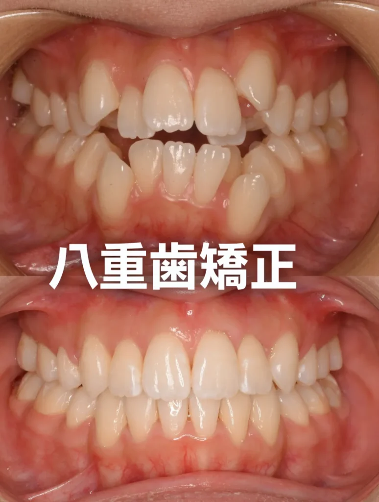 難症例への対応力
