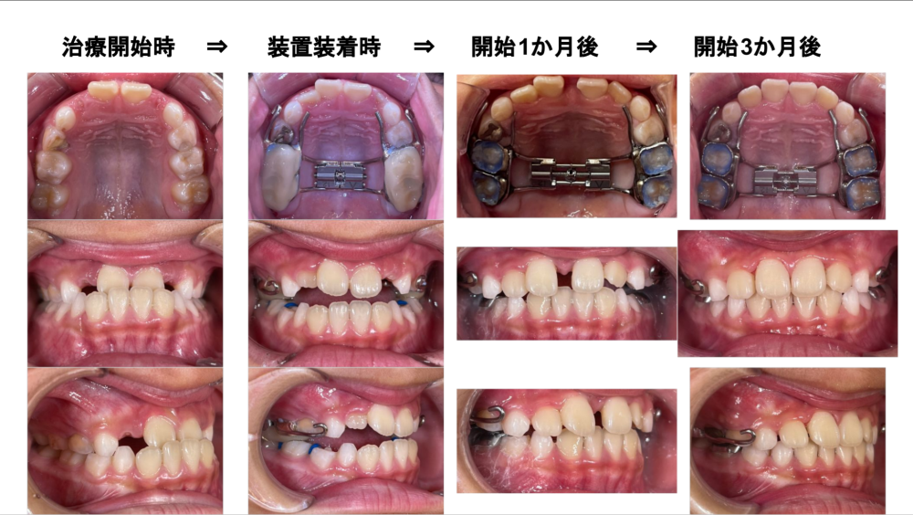 治療開始から3ヶ月